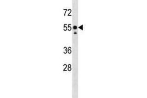 Src antibody western blot analysis in mouse liver tissue lysate.