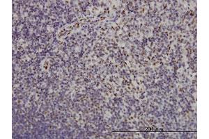 Immunoperoxidase of monoclonal antibody to TSC22D3 on formalin-fixed paraffin-embedded human lymph node.