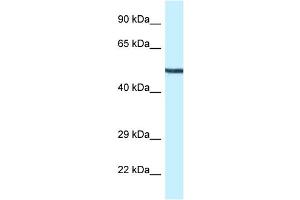 WB Suggested Anti-Map2k5 Antibody Titration: 1. (MAP2K5 anticorps  (N-Term))