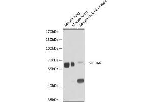 Western blot analysis of extracts of various cell lines, using SLC9 antibody (ABIN6131139, ABIN6148056, ABIN6148057 and ABIN6224211) at 1:1000 dilution. (SLC9A6 anticorps  (AA 542-701))