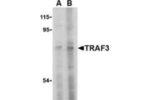 Western blot analysis of TRAF3 in HeLa cell lysate with this product at (A) 2 and (B) 4 μg/ml. (TRAF3 anticorps  (N-Term))