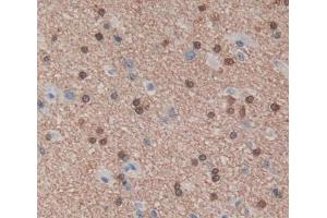 Used in DAB staining on fromalin fixed paraffin- embedded brain tissue