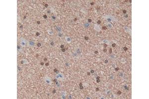 Used in DAB staining on fromalin fixed paraffin- embedded brain tissue (PUF60 anticorps  (AA 226-549))