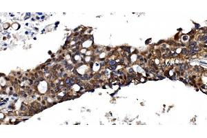 IHC analysis of TBP-1/PSMC3 using anti-TBP-1/PSMC3 antibody (ABIN7599393).