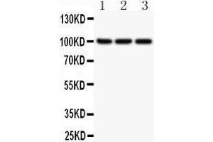 Anti-NFkB p100 Picoband antibody,  All lanes: Anti NFKBP100  at 0.