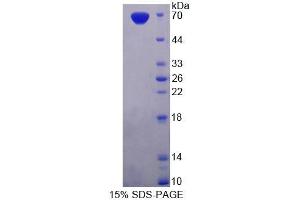 SDS-PAGE analysis of Rat PDE3A Protein. (PDE3A Protéine)