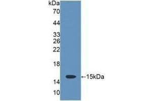 Detection of Recombinant CD7, Rat using Polyclonal Antibody to Cluster Of Differentiation 7 (CD7) (CD7 anticorps  (AA 23-128))