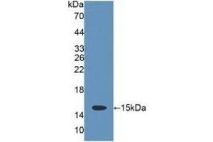 Detection of Recombinant CD7, Rat using Polyclonal Antibody to Cluster Of Differentiation 7 (CD7) (CD7 anticorps  (AA 23-128))
