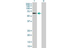 Lane 1: EGR2 transfected lysate ( 50. (EGR2 293T Cell Transient Overexpression Lysate(Denatured))