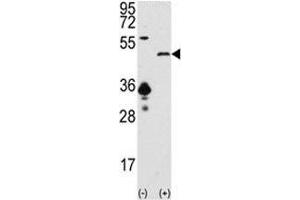 Western blot analysis of SIRT7 antibody and 293 cell lysate (2 ug/lane) either nontransfected (Lane 1) or transiently transfected with the SIRT7 gene (2).