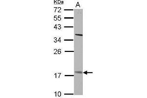 WB Image Sample (30 ug of whole cell lysate) A: H1299 12% SDS PAGE antibody diluted at 1:500 (PNPLA4 anticorps)