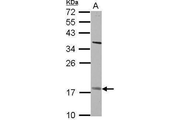 PNPLA4 anticorps