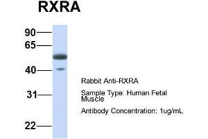 Host:  Rabbit  Target Name:  RXRA  Sample Type:  Human Fetal Muscle  Antibody Dilution:  1. (Retinoid X Receptor alpha anticorps  (N-Term))