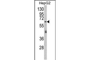 Western blot analysis of RARS2 Antibody in HepG2 cell line lysates (35ug/lane) (RARS2 anticorps  (C-Term))