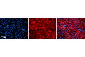 Rabbit Anti-Snf8 Antibody    Formalin Fixed Paraffin Embedded Tissue: Human Adult liver  Observed Staining: Cytoplasmic Primary Antibody Concentration: 1:100 Secondary Antibody: Donkey anti-Rabbit-Cy2/3 Secondary Antibody Concentration: 1:200 Magnification: 20X Exposure Time: 0. (SNF8 anticorps  (N-Term))