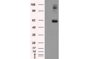 Image no. 1 for anti-Lipase, Endothelial (LIPG) antibody (ABIN1499162) (LIPG anticorps)