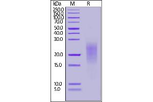 Human ALK-7, His Tag on  under reducing (R) condition.