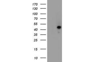 Western Blotting (WB) image for anti-serpin Peptidase Inhibitor, Clade A (Alpha-1 Antiproteinase, Antitrypsin), Member 5 (SERPINA5) antibody (ABIN1500054) (SERPINA5 anticorps)