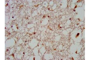 IHC image of ABIN7165031 diluted at 1:600 and staining in paraffin-embedded human brain tissue performed on a Leica BondTM system. (GNAS anticorps  (AA 310-404))
