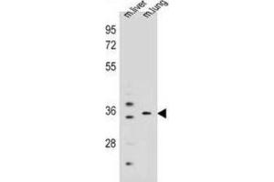 Western Blotting (WB) image for anti-Potassium Channel Regulator (KCNRG) antibody (ABIN2995148)
