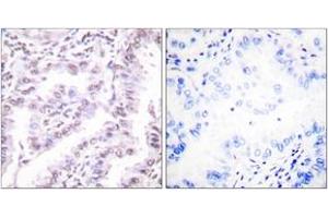 Immunohistochemistry (IHC) image for anti-X-Ray Repair Complementing Defective Repair in Chinese Hamster Cells 5 (Double-Strand-Break Rejoining) (XRCC5) (AA 683-732) antibody (ABIN2888643) (XRCC5 anticorps  (AA 683-732))