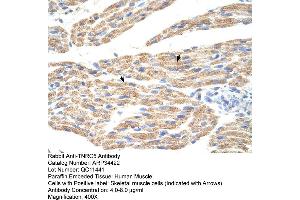 Human Muscle (TNRC5 anticorps  (C-Term))