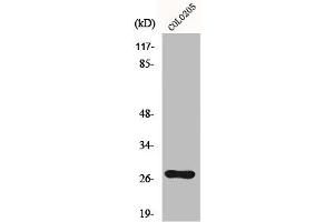Western Blot analysis of Colo205 cells using OTUB2 Polyclonal Antibody (OTUB2 anticorps  (Internal Region))