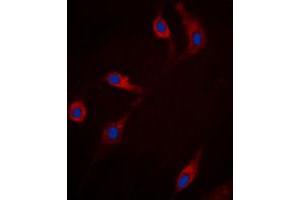 Immunofluorescent analysis of RRAD staining in HepG2 cells. (RRAD anticorps  (Center))