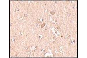 Immunohistochemistry of MED28 in human brain tissue with this product at 2. (MED28 anticorps  (Center))