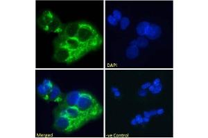 Immunofluoresence staining of fixed HepG2 cells with anti-Alpha-fetoprotein (AFP) antibody AF5.