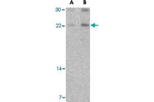 Western blot analysis of CBLN1 in mouse cerebellum tissue lysate with CBLN1 polyclonal antibody  at (A) 2 and (B) 4 ug/mL .