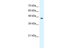 Western Blotting (WB) image for anti-GLIS Family Zinc Finger 3 (GLIS3) antibody (ABIN2461993) (GLIS3 anticorps)