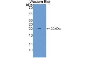 Western blot analysis of the recombinant protein. (Cytokeratin 18 anticorps  (AA 1-159))