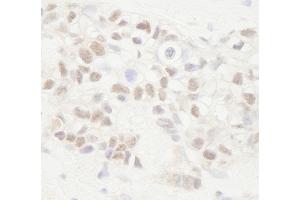 Immunohistochemistry (IHC) image for anti-Adenomatous Polyposis Coli (APC) (AA 1-50) antibody (ABIN7454383)