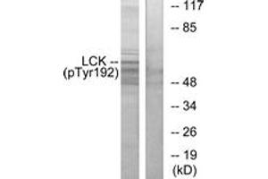 Western blot analysis of extracts from Jurkat cells, using Lck (Phospho-Tyr192) Antibody. (LCK anticorps  (pTyr192))