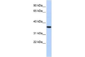 WB Suggested Anti-CPXCR1 Antibody Titration: 1 ug/ml Positive Control: Fetal Brain Lysate (CPXCR1 anticorps  (Middle Region))