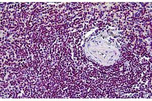 Human Spleen: Formalin-Fixed, Paraffin-Embedded (FFPE) (CDK6 anticorps  (AA 3-100))