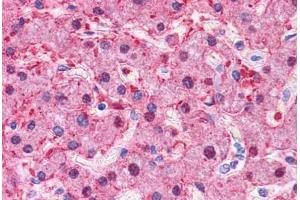 Human Liver: Formalin-Fixed, Paraffin-Embedded (FFPE)