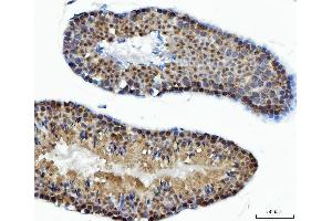 IHC analysis of ACLY using anti-ACLY antibody (ABIN4886416).