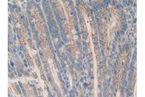 DAB staining on IHC-P; Samples: Mouse Intestine Tissue (MCL-1 anticorps  (AA 2-307))