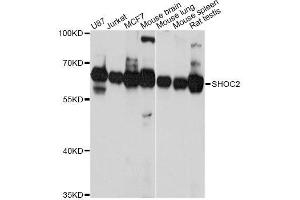 Western blot analysis of extracts of various cell lines, using SHOC2 Antibody. (SHoc2/Sur8 anticorps  (AA 1-280))
