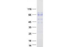 Validation with Western Blot