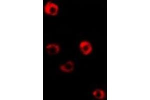 Immunofluorescent analysis of Tropomyosin 3 staining in Hela cells. (TPM3 anticorps)