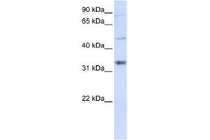 WB Suggested Anti-ZCCHC17 Antibody Titration:  0. (ZCCHC17 anticorps  (Middle Region))