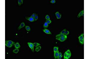 anti-Microsomal Triglyceride Transfer Protein (MTTP) (AA 19-151) antibody