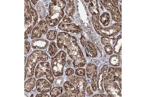 Immunohistochemical staining of human kidney with ACTR6 polyclonal antibody  shows strong cytoplasmic positivity in renal tubules. (ACTR6 anticorps)