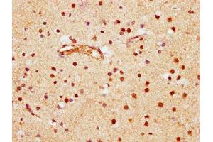 IHC image of ABIN7145804 diluted at 1:600 and staining in paraffin-embedded human brain tissue performed on a Leica BondTM system.
