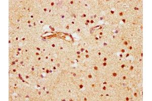 IHC image of ABIN7145804 diluted at 1:600 and staining in paraffin-embedded human brain tissue performed on a Leica BondTM system. (BRD1 anticorps  (AA 756-879))