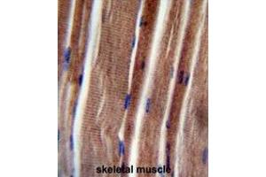 THUM3 Antibody (Center) immunohistochemistry analysis in formalin fixed and paraffin embedded human skeletal muscle followed by peroxidase conjugation of the secondary antibody and DAB staining.