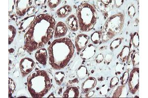 Image no. 8 for anti-serpin Peptidase Inhibitor, Clade B (Ovalbumin), Member 1 (SERPINB1) (AA 77-306) antibody (ABIN1491670)